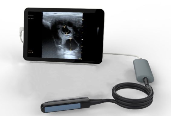 Hand held Ultrasound 